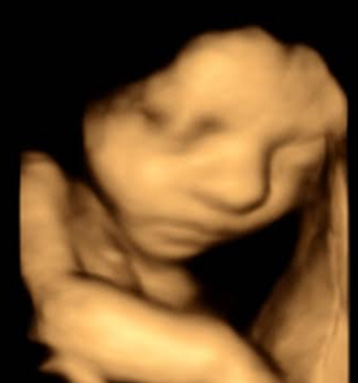 4D scans