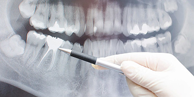 Dental Imaging